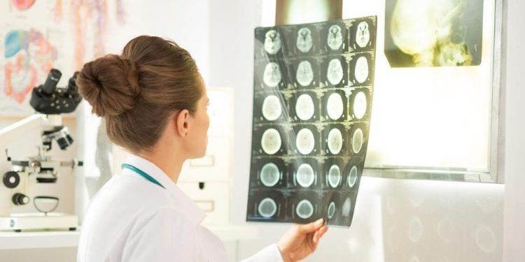 Requisitos para ser neuropsicólogo en España